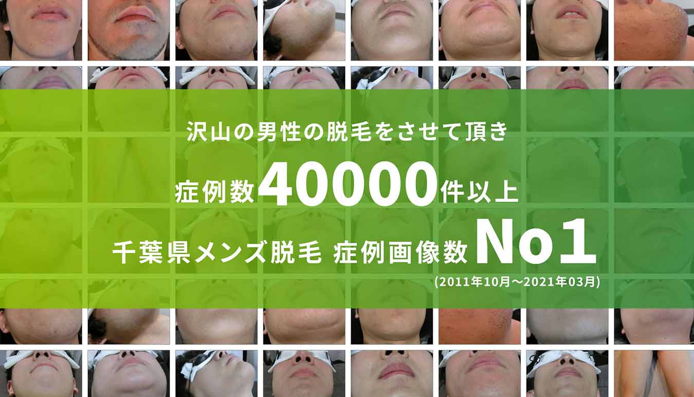 沢山の男性の脱毛をさせて頂き症例数40000件以上 千葉県メンズ脱毛症例画像数No.1