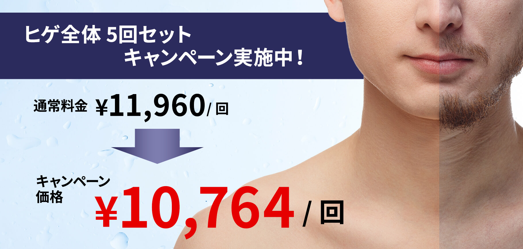 ヒゲ全体5回セットキャンペーン実施中！通常料金59,800円がキャンペーン価格53,820円に。