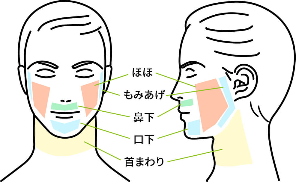 脱毛範囲 ヒゲ