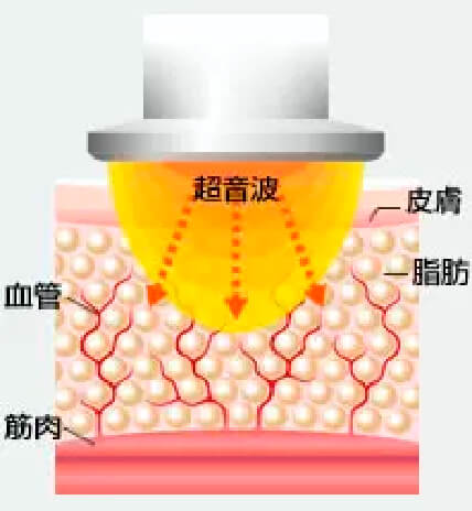 痩身図解1